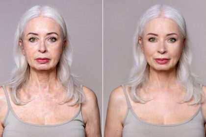 Celebrity plastic surgeon reveals when it’s too soon for a facelift, and when waiting can backfire