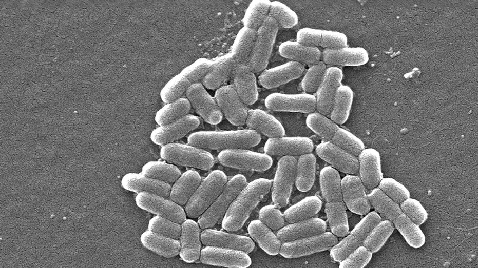 ecoli under microscope