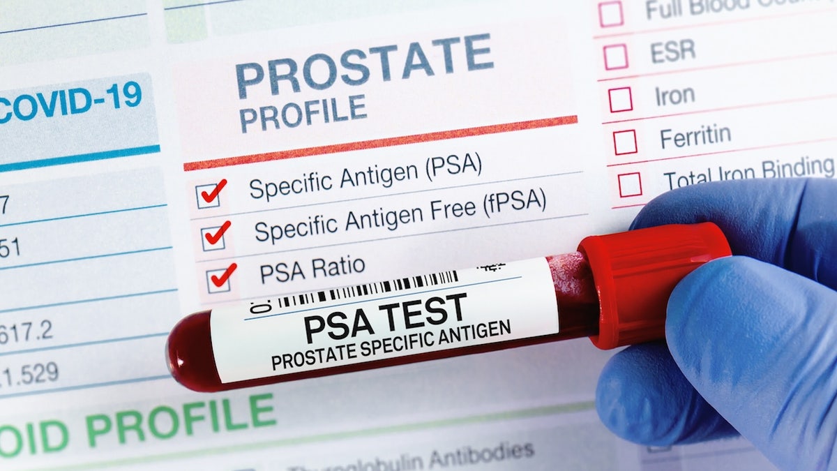 PSA test
